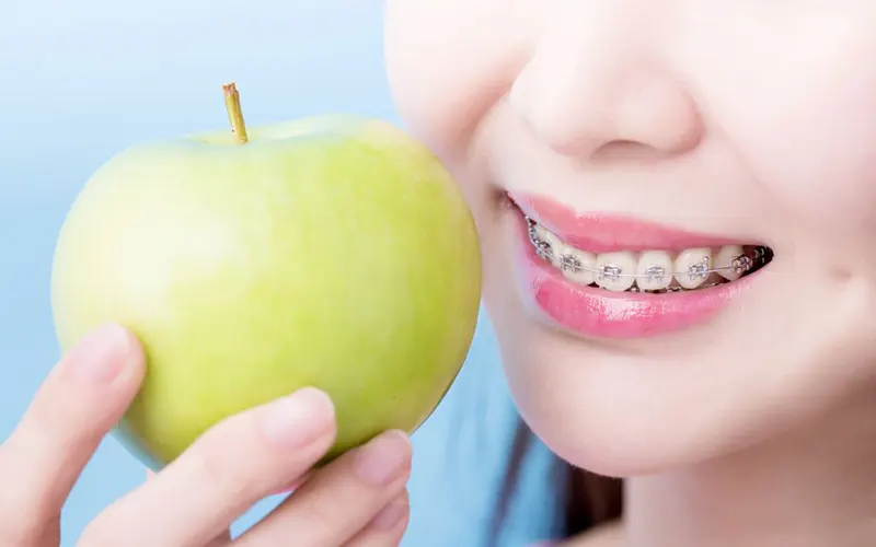 تغذیه مناسب در دوران ارتودنسی