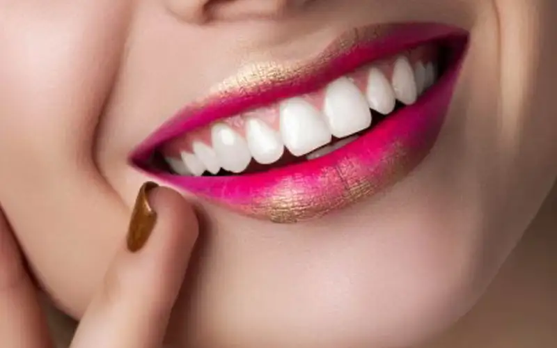 تفاوت ارتودنسی و لمینت از نظر تأثیرات طولانی‌مدت