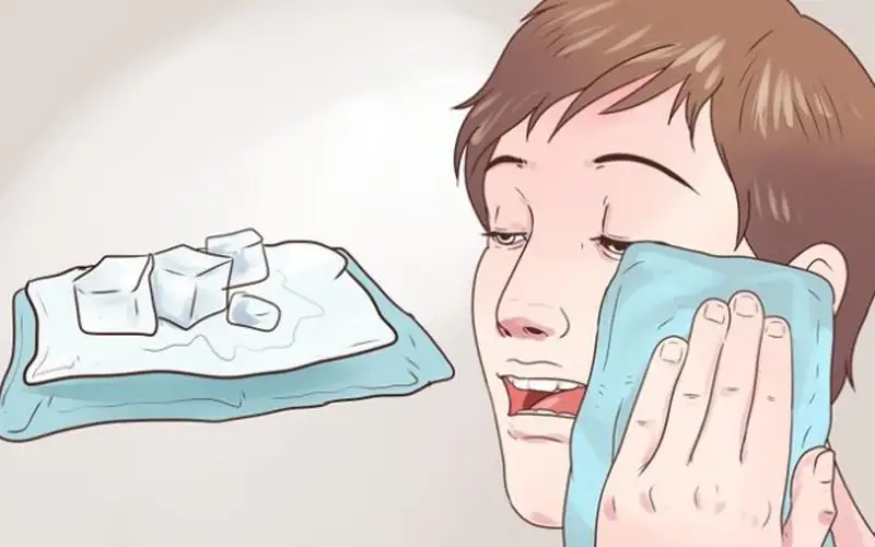 استفاده از کمپرس سرد
