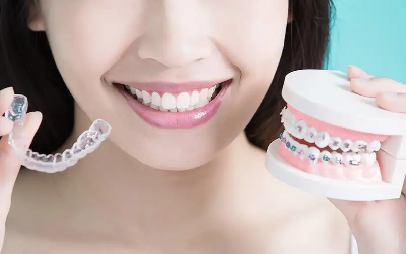 جلوگیری از بازگشت دندان بعد ارتودنسی