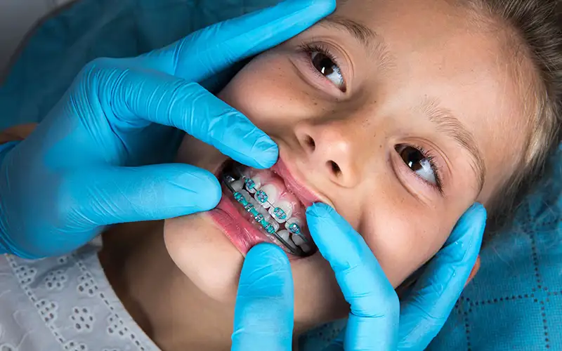 ارتودنسی برای کودکان
