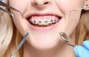 ارتودنسی چیست؟