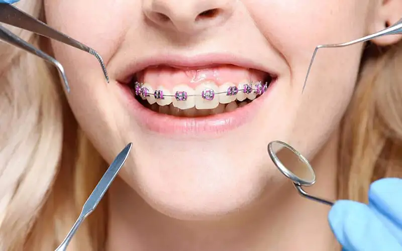 ارتودنسی چیست؟