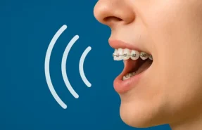 بهبود تلفظ با ارتودنسی