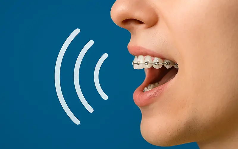 بهبود تلفظ با ارتودنسی