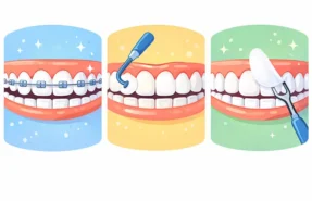 مقایسه ارتودنسی با کامپوزیت و لمینیت