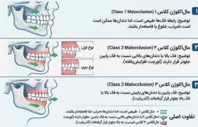 مال‌اکلوژن چیست و چرا در ارتودنسی اهمیت دارد؟