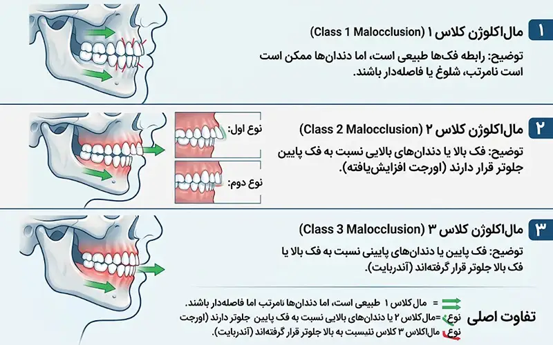 مال‌اکلوژن چیست و چرا در ارتودنسی اهمیت دارد؟